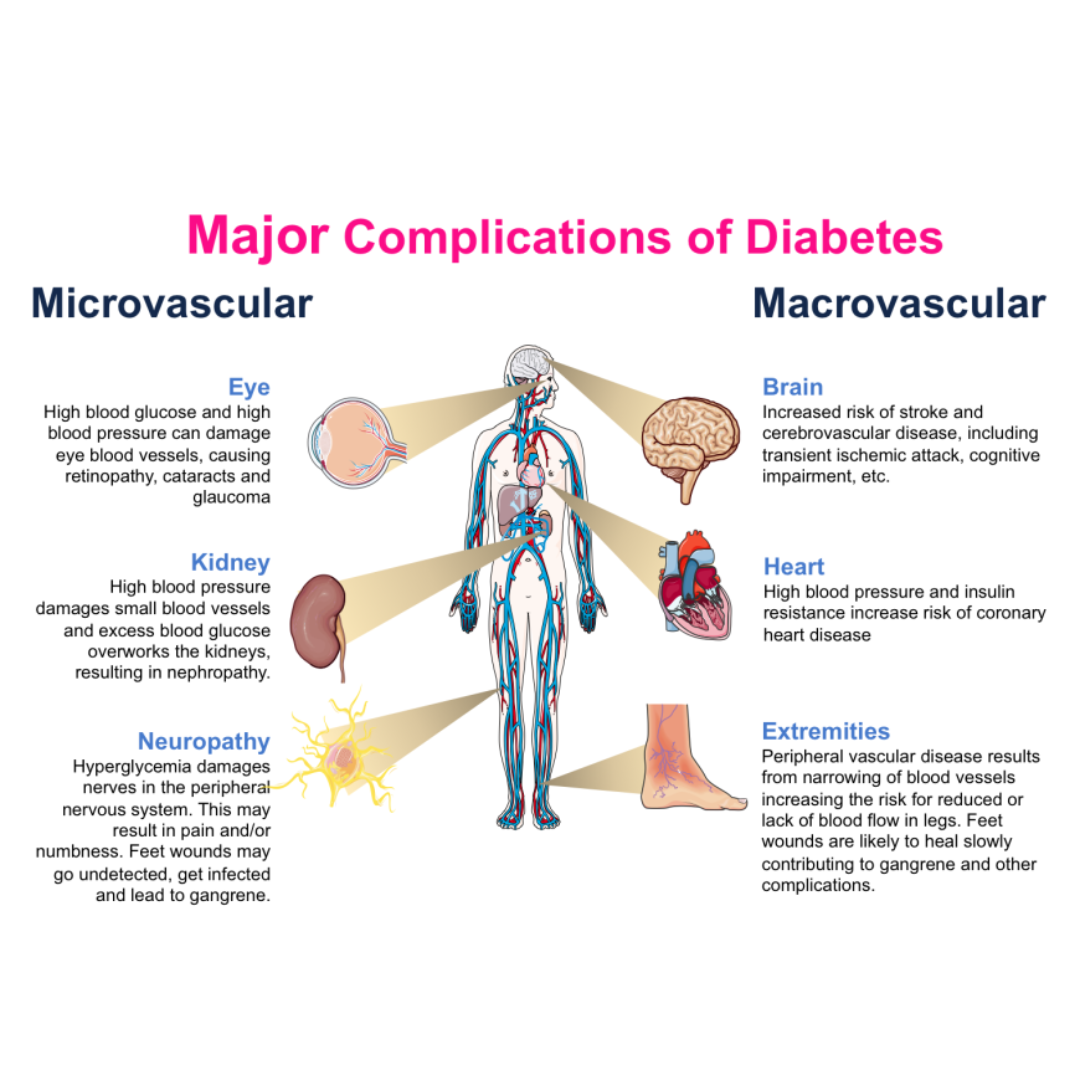 Microvascular Complications in Diabetes 20 Prevention.